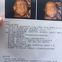 刚照的四维！帮忙看看是男宝还是女宝