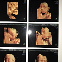 会看的妈妈帮看看男宝还是女宝