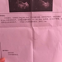 大家帮忙看看我的排卵B超单子，看看多久才能排卵啊