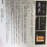 哪位大神级妈妈能看出男孩女孩吗？