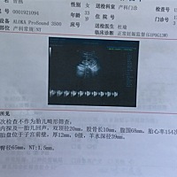 请大家帮我看看，今天刚做的nt