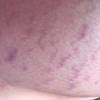 肚子都是纹纹真难看。哎