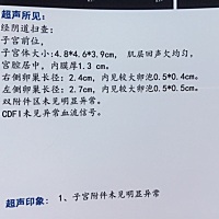 至少月经一直比较准，每个月1号前后，排卵靠后，4月份提前了26号来的月经，中间试纸检测没有排卵，今天5...
