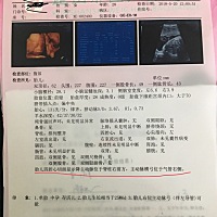 排畸檢查出來了，主動脈橫弓位於氣管右側，現在不知道要怎麼辦