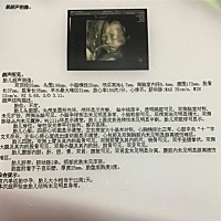 请问是男宝还是女宝，哈哈