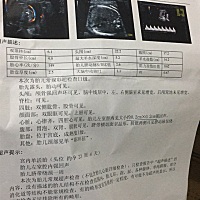 怀孕24周 4，今天去做了彩超. 检查胎儿左室腔内见大小0.2×0.2强回声.医生让做胎儿心脏彩超检查，很担心...