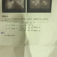 今天去照B超显示卵泡已经成熟到21mmX21mm，医生建议我们这几天都安排同房。希望接好孕😛😛😛