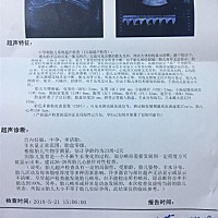 怎么看男宝女宝？有懂的吗