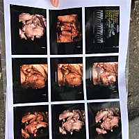 刚刚出炉四维彩超，求看男女，谢谢！