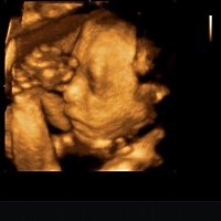 大宝是个儿子，二宝还是个儿子😭😭😭我的女儿梦彻底破灭