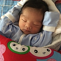 男宝宝肩上背上额头长了好多黑汗毛，长大些会掉吗，怕影响以后的美观