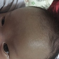 一个多月宝宝，这青是怎么回事啊？好担心啊。宝妈们