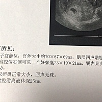 应该是个穿小裙子的吧？有会看的宝妈吗？好奇