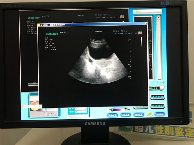 月经第十三天医生说卵泡成熟了