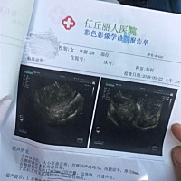 这个月我想打算准备要怀孕，月经第十四天同房了，月经第十五天也同房了，今晚可以同房吗？会不会怀孕了...