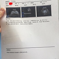 麻烦大家猜猜是女孩男孩
