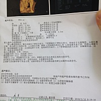 看看男宝还是女宝