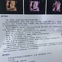 闺女，初次见面！你好。