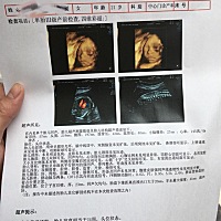 四维，能看出男女吗😁