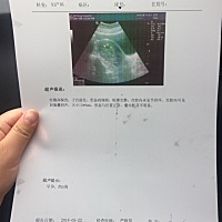 这是我一星期前做的单子，要我再过半个月去检查是否有胎心，这是正常现象吗，求告