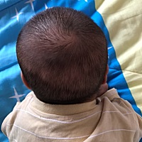 儿子头睡歪了，左侧头偏高，朋友们怎么纠正呀？