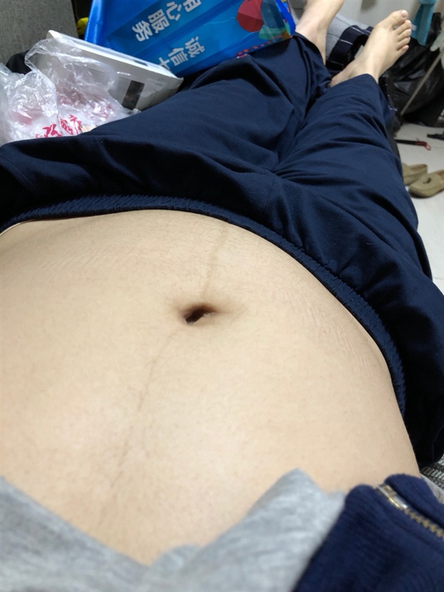 18➕4的肚子，你们是什么样的？