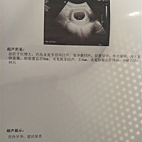 帮忙看看是什么情况，心里担心，