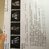有没有宝妈会看宝宝性别的，好奇心好重！