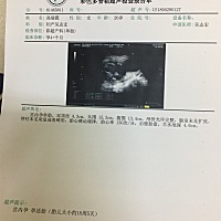 大家看下是男孩还是女孩啊，