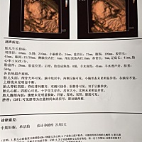 宝妈们帮忙看下女宝还是男宝