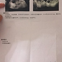 又要开始进入漫长的岁月了☺️