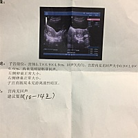 大家能不能帮我看下，我这B超单有没有孕囊，一身没具体说，我也没问清楚，四十天做的B超，但是还没有胎...