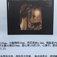 上下爬楼 摆弄奇怪的姿势 终于通过四维 不懂是不是妹妹💗