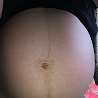 这两天肚皮都是疼的，花的像个西瓜😢