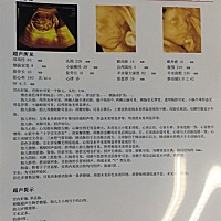 四维彩照，羊水多怎么办，产前诊断没号了，宝妈依然坚持上班要到星期天才有空去看产前诊断。上次做个无...