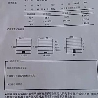 来接唐筛顺利通过哦，顺便问一下这个有人说能看出男孩女孩，有人会看吗？