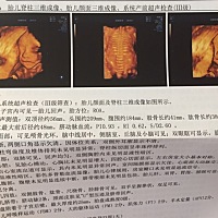 照三维，有经历的朋友帮忙看看这个娃娃咋样