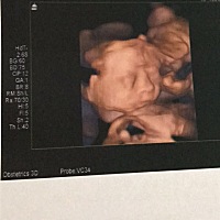 男孩女孩？？？？谁懂看？？？