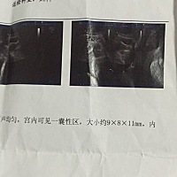 已经知道男女，大家猜猜看😁