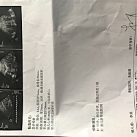 这是男孩还是女孩阿