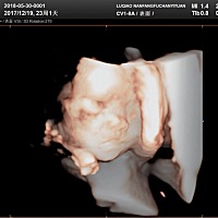 今天做了5D，顺利通过，宝宝一切健康成长，就是不知道男孩还是女孩