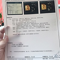 麻烦大家看看从四维彩超上能看出男女吗？很好奇。