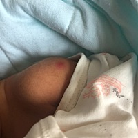 问一下大家这长的是什么