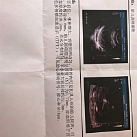 三个月能看出来男女吗