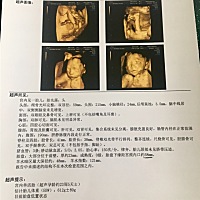 四维顺利通过，彩超期间第一次不太配合没有看到脸，又让出去运动下，第二次回来宝宝挺配合的。在检查期...
