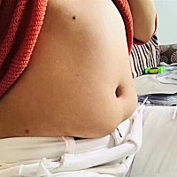 刚生完肚子是这样的宝妈举爪😂