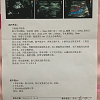 有会看性别的宝妈吗?纯属好奇,男女都喜欢,