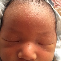 宝宝8天   额头这样正常吗