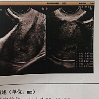 各位宝妈帮忙看看 怀孕多久了