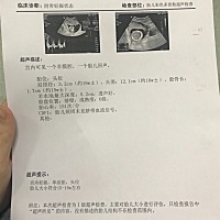 我这是男宝还是女宝啊，有会看的宝妈么？